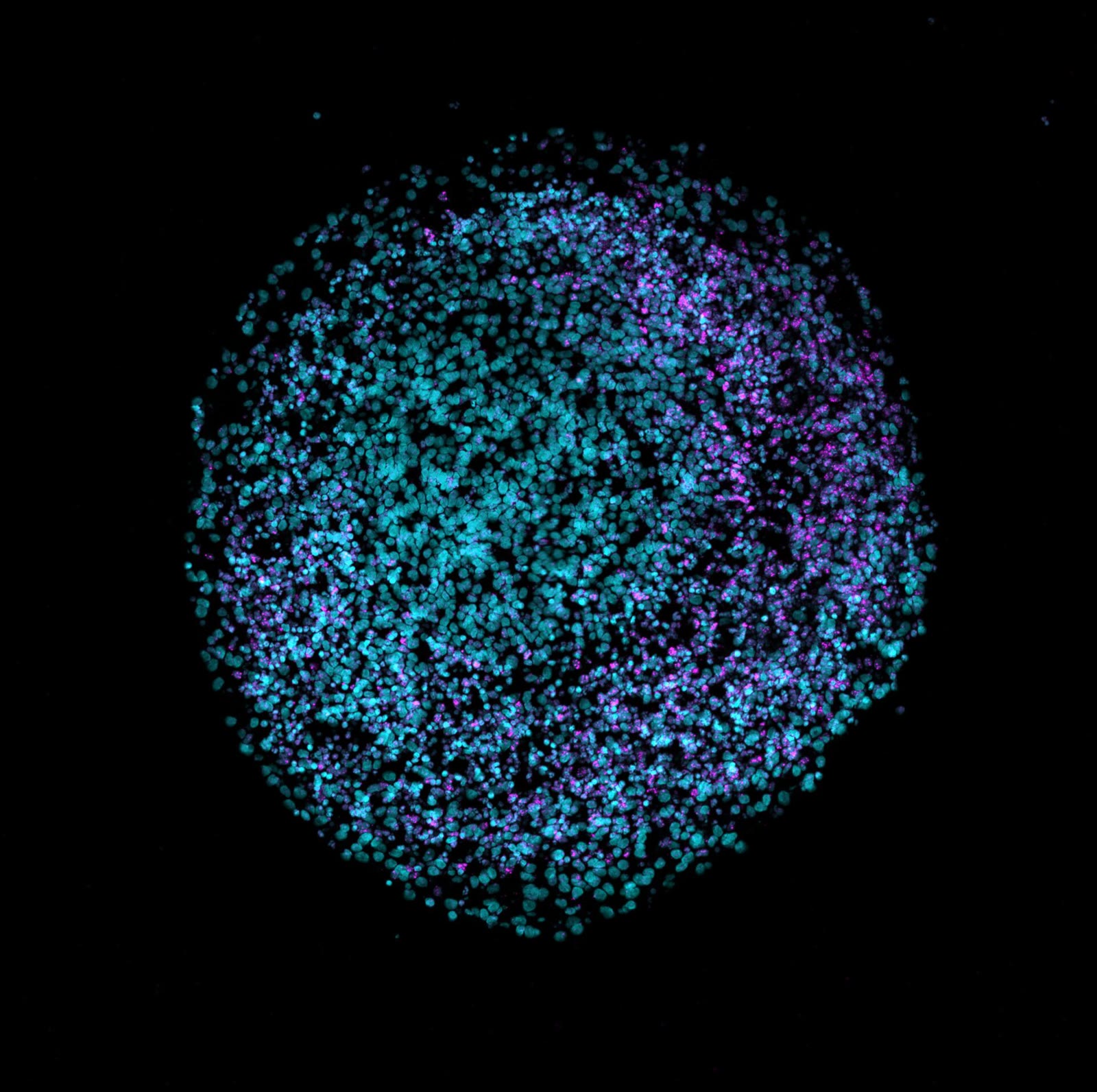 Imagen al microscopio de un organoide cerebral humano, una esfera de puntos azules y morados sobre fondo negro